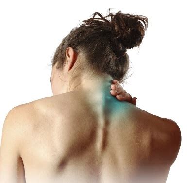 синдроми на остеохондрозата на шийния гръбнак
